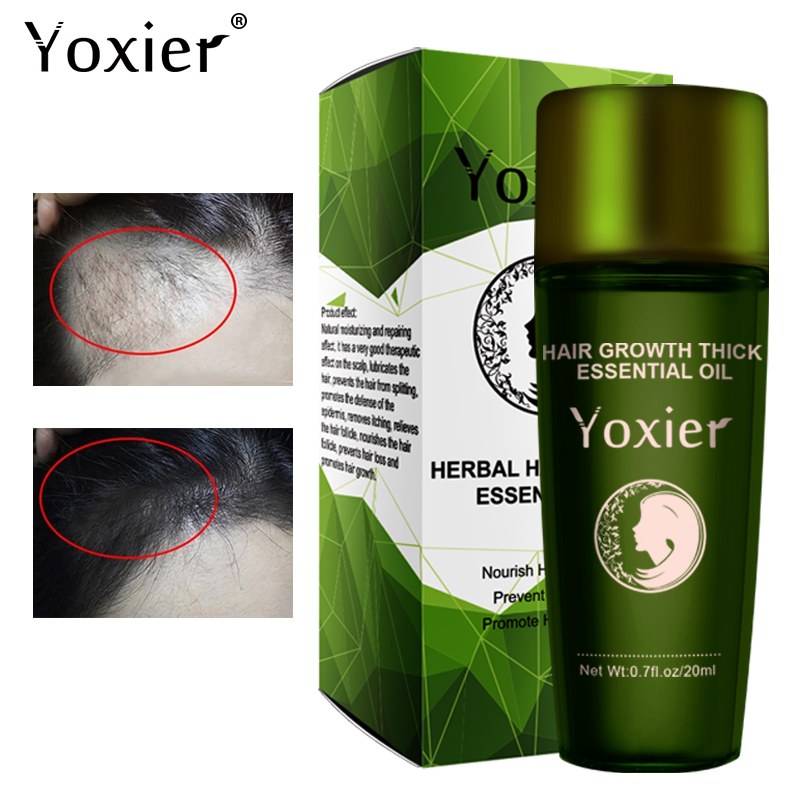 Hair Care Herbal Products - Yoxier Herbal Hair Growth Essential Oil