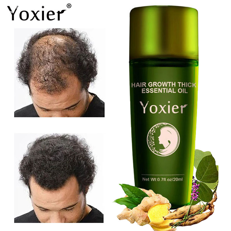 Yoxier Herbal Hair Growth Esse - Hair Care Herbal Products recensione e prezzo