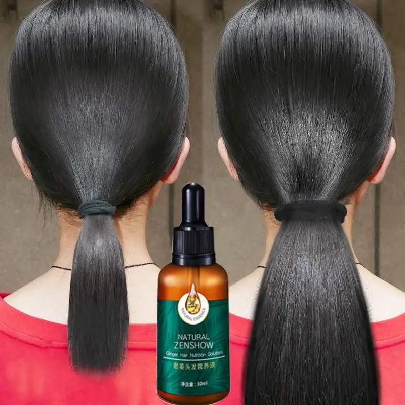 Ginger Hair Growth Essential O - Hair Care Herbal Products recensione e prezzo