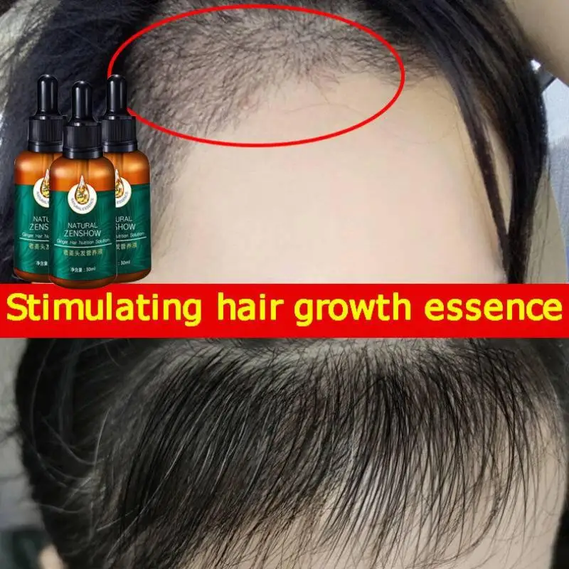 Ginger Hair Growth Essential O - Hair Care Herbal Products recensione e prezzo