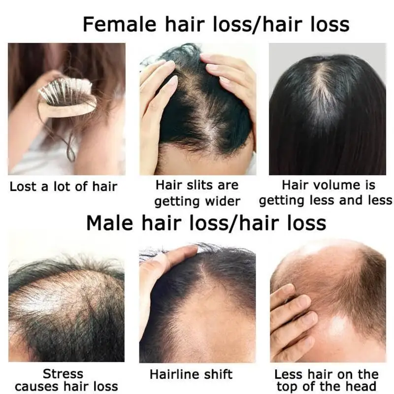 Ginger Hair Growth Essential O - Hair Care Herbal Products recensione e prezzo