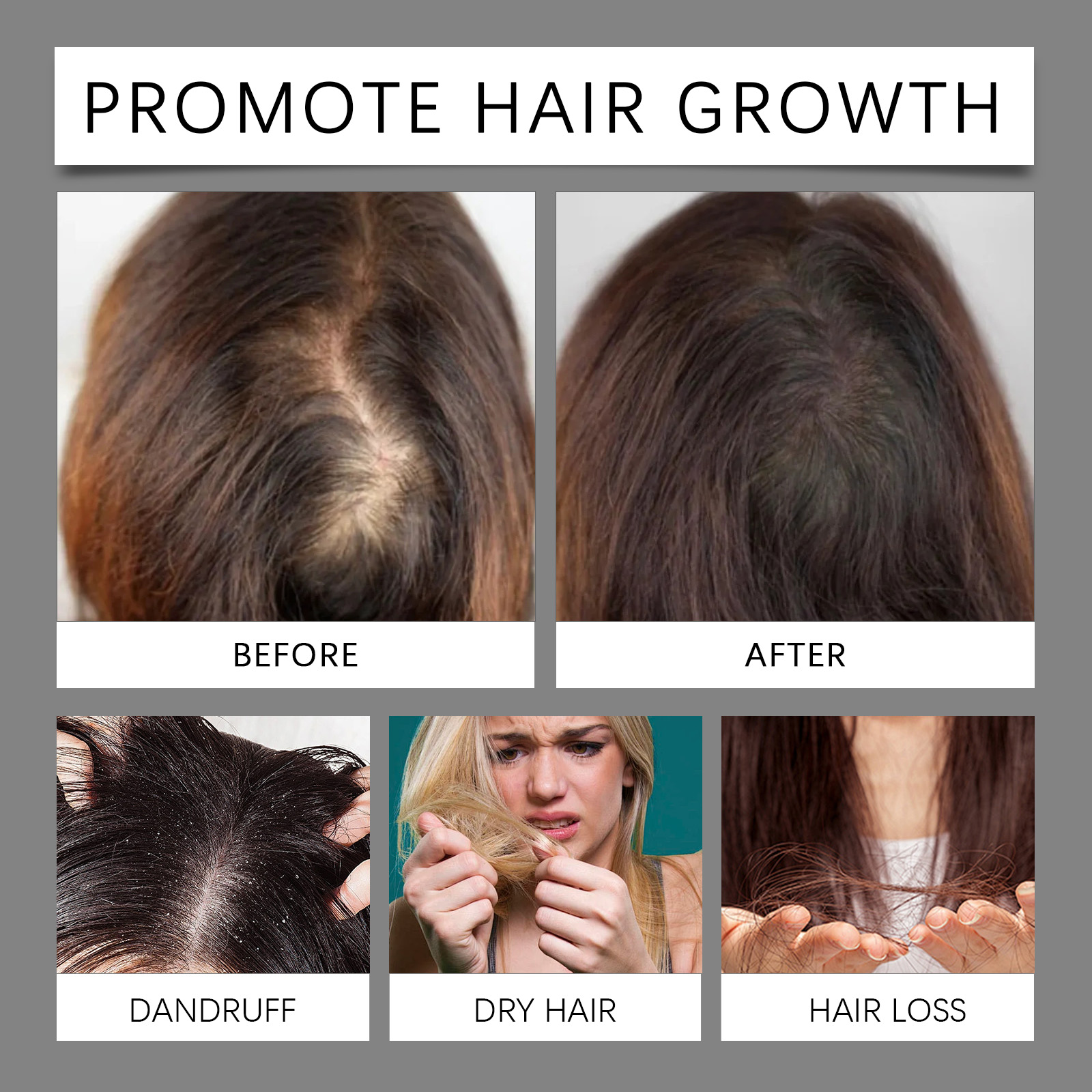 30ml Hair Care Essential Oil T - Hair Growth Serum Oil recensione e prezzo