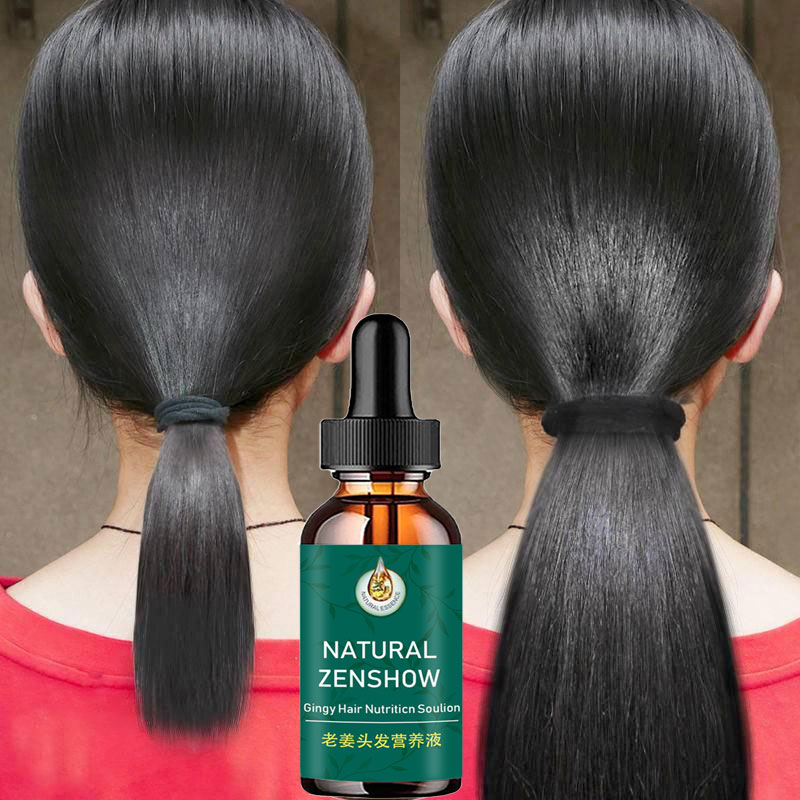Ginger Hair Growth Essential O - Hair Care Herbal Products recensione e prezzo