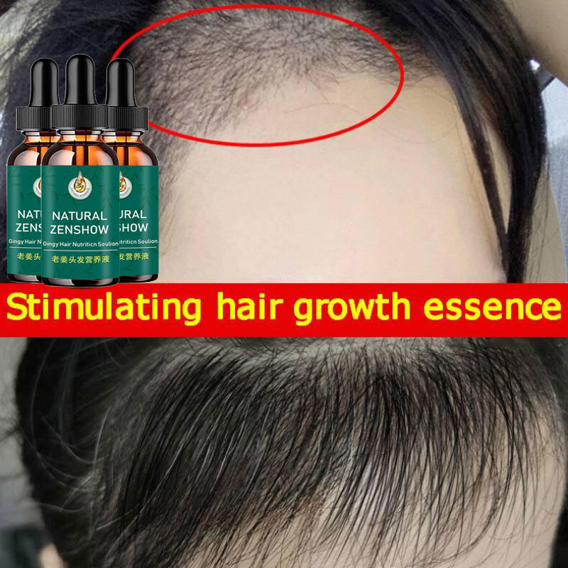 Ginger Hair Growth Essential O - Hair Care Herbal Products recensione e prezzo