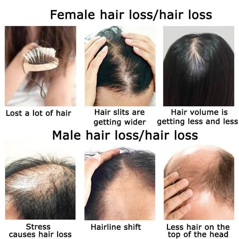 Ginger Hair Growth Essential O - Hair Care Herbal Products recensione e prezzo
