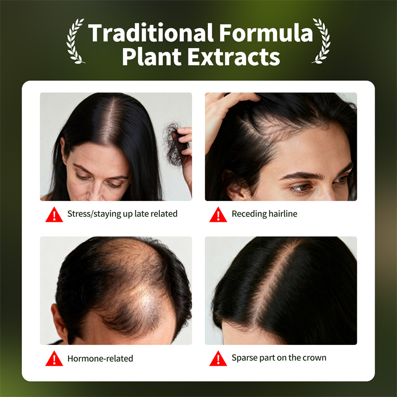 Natural Hair Growth Set Usman  - Hair Care Herbal Products recensione e prezzo