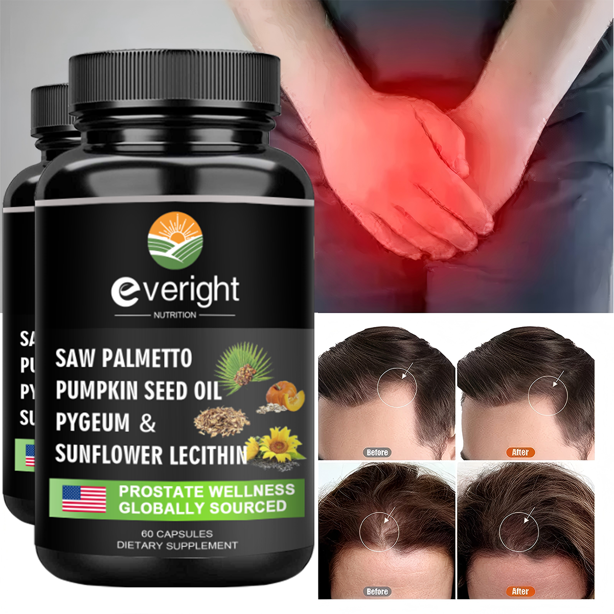 Saw Palmetto Capsules - Prosta - Hair Care Capsule recensione e prezzo