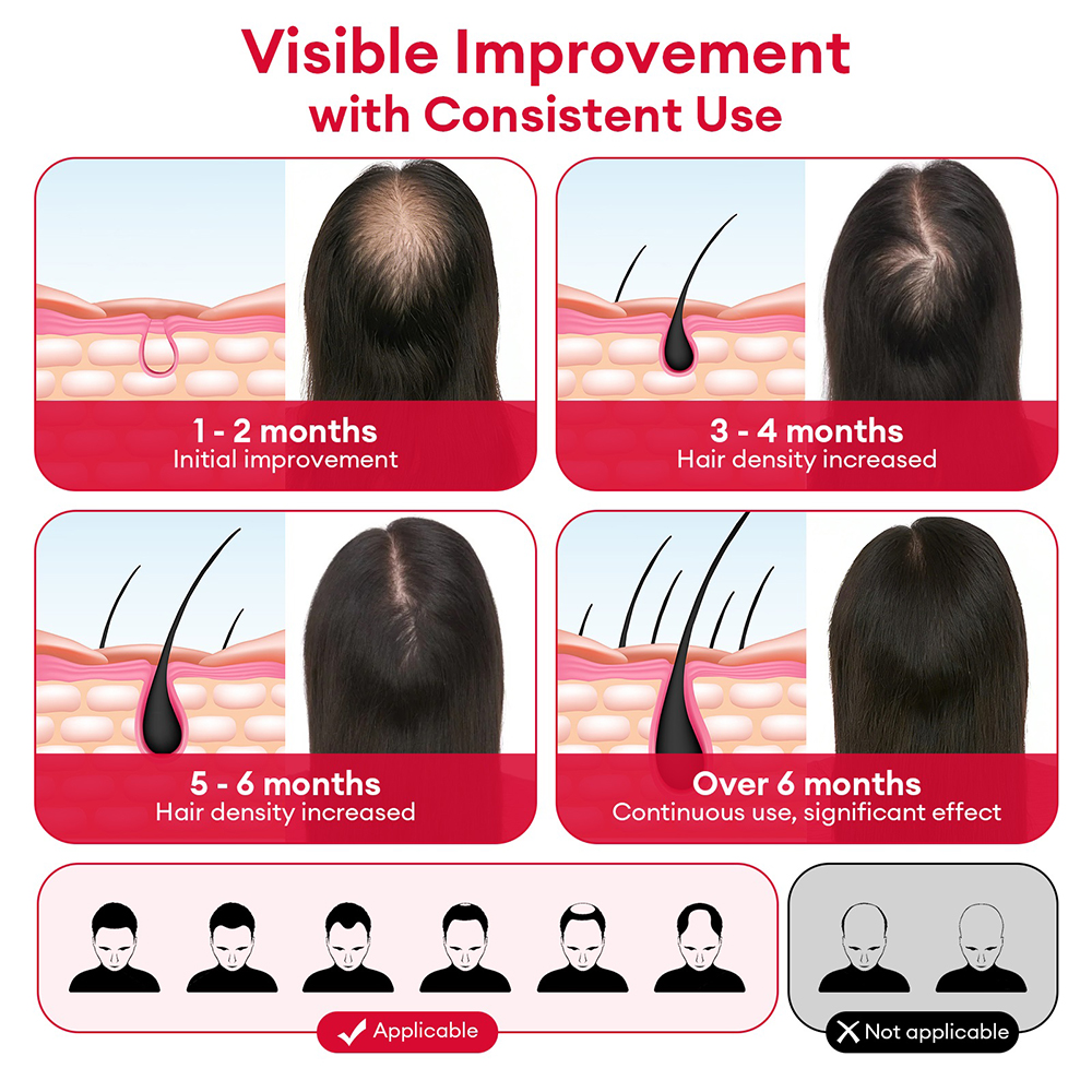 650nm+850nm Red Light Infrared - Hair Care Nutrition recensione e prezzo