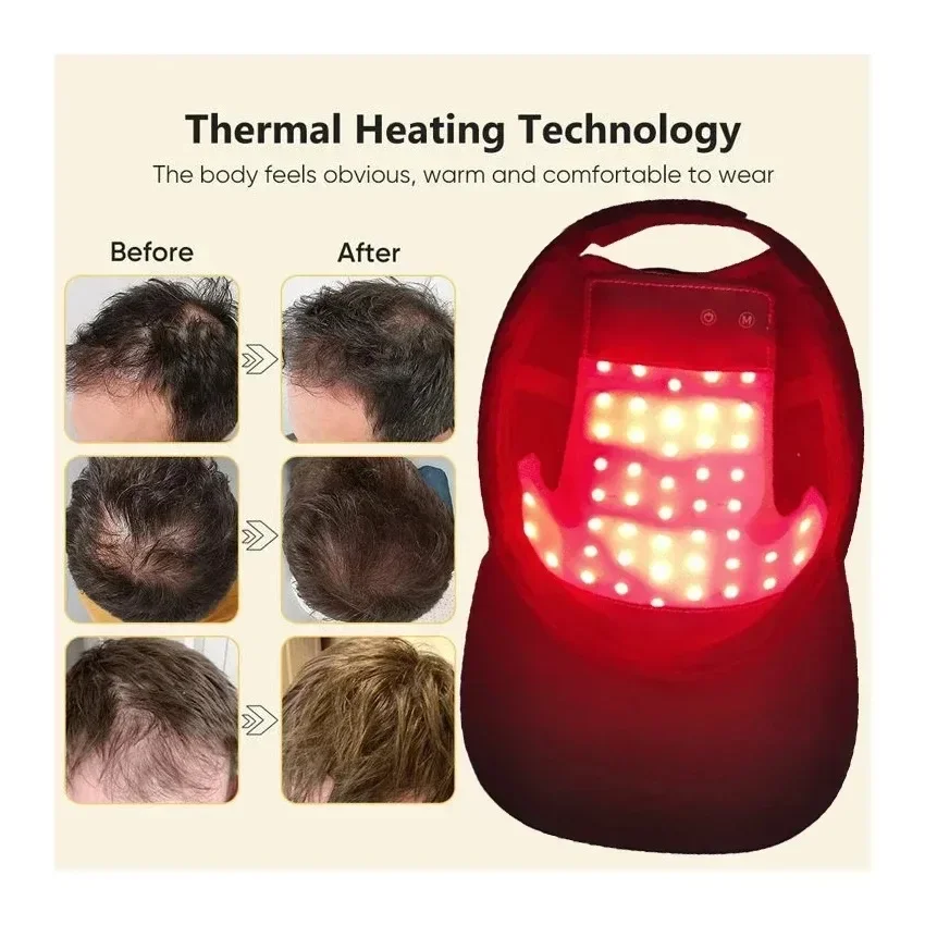 NEW LED Red Blue Light Therapy - Hair Care Nutrition recensione e prezzo
