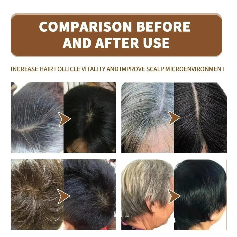 Herbal Anti-grey Treatment Hai - Hair Care Herbal Products recensione e prezzo