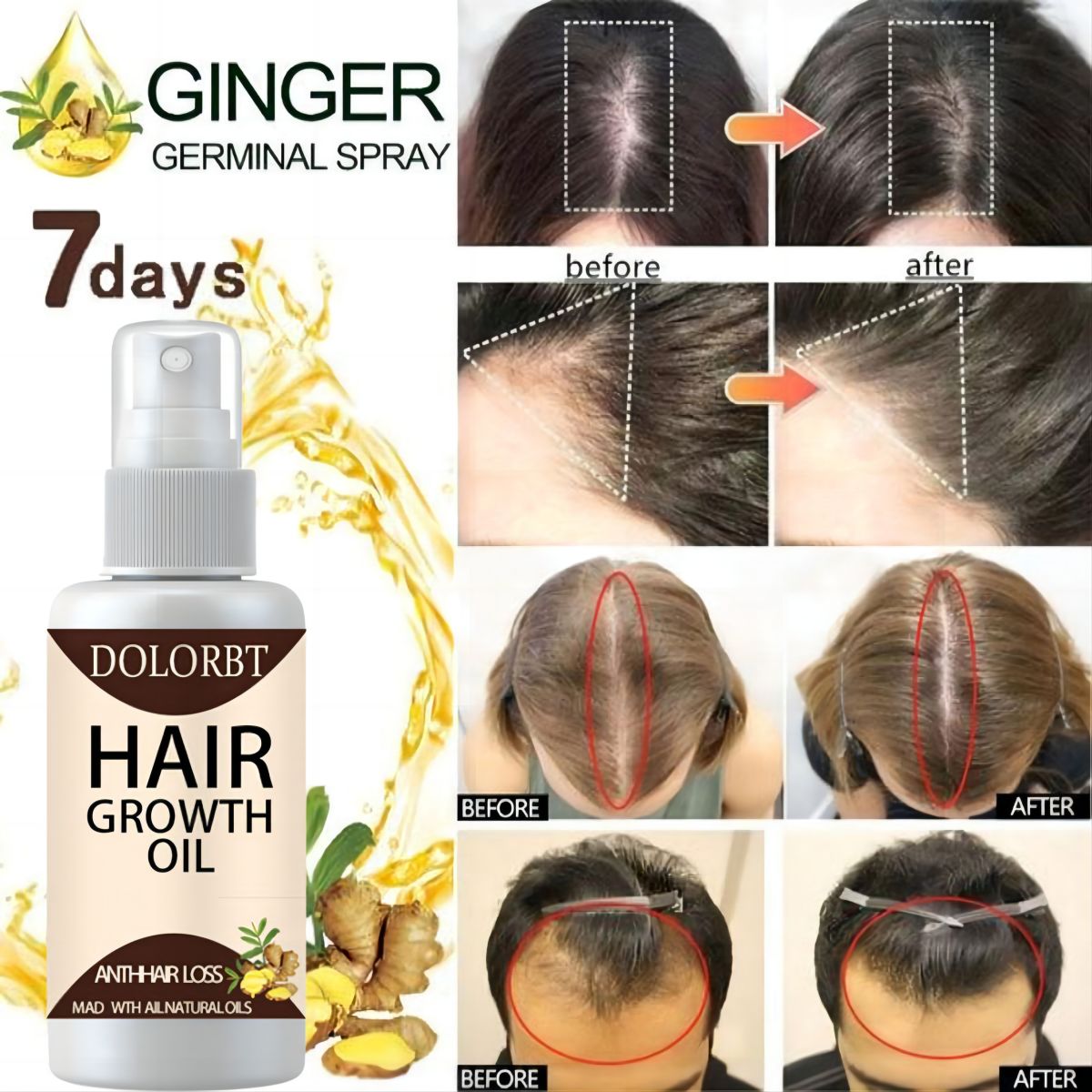 Hair Growth Essence Oil Spray  - Hair Care Herbal Products recensione e prezzo