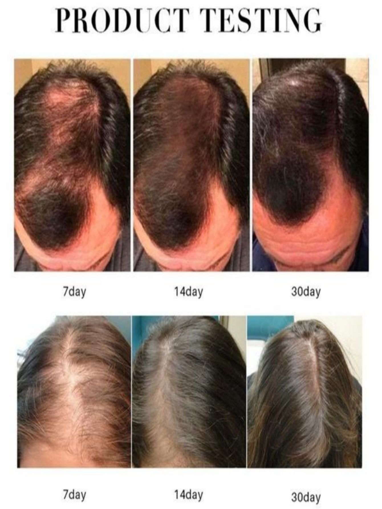 Hair Growth Essence Oil Spray  - Hair Care Herbal Products recensione e prezzo