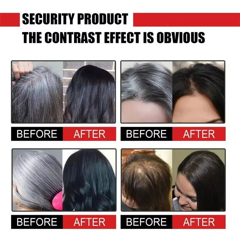 Herbal Anti-grey Hair Treatmen - Hair Care Herbal Products recensione e prezzo