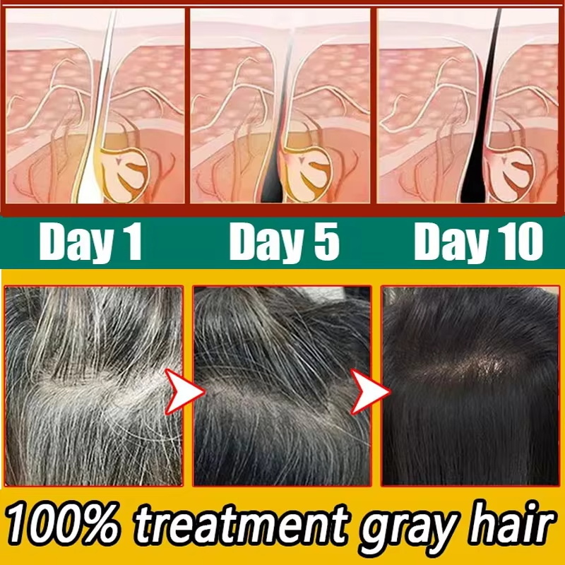 Herbal Anti-grey Hair Treatmen - Hair Care Herbal Products recensione e prezzo
