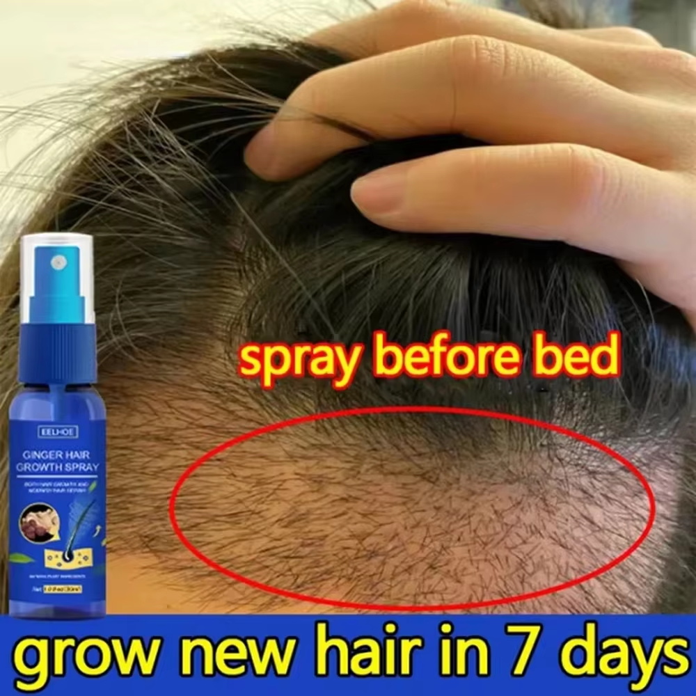 Ginger Hair Growth spray Anti  - Hair Care Nutrition recensione e prezzo