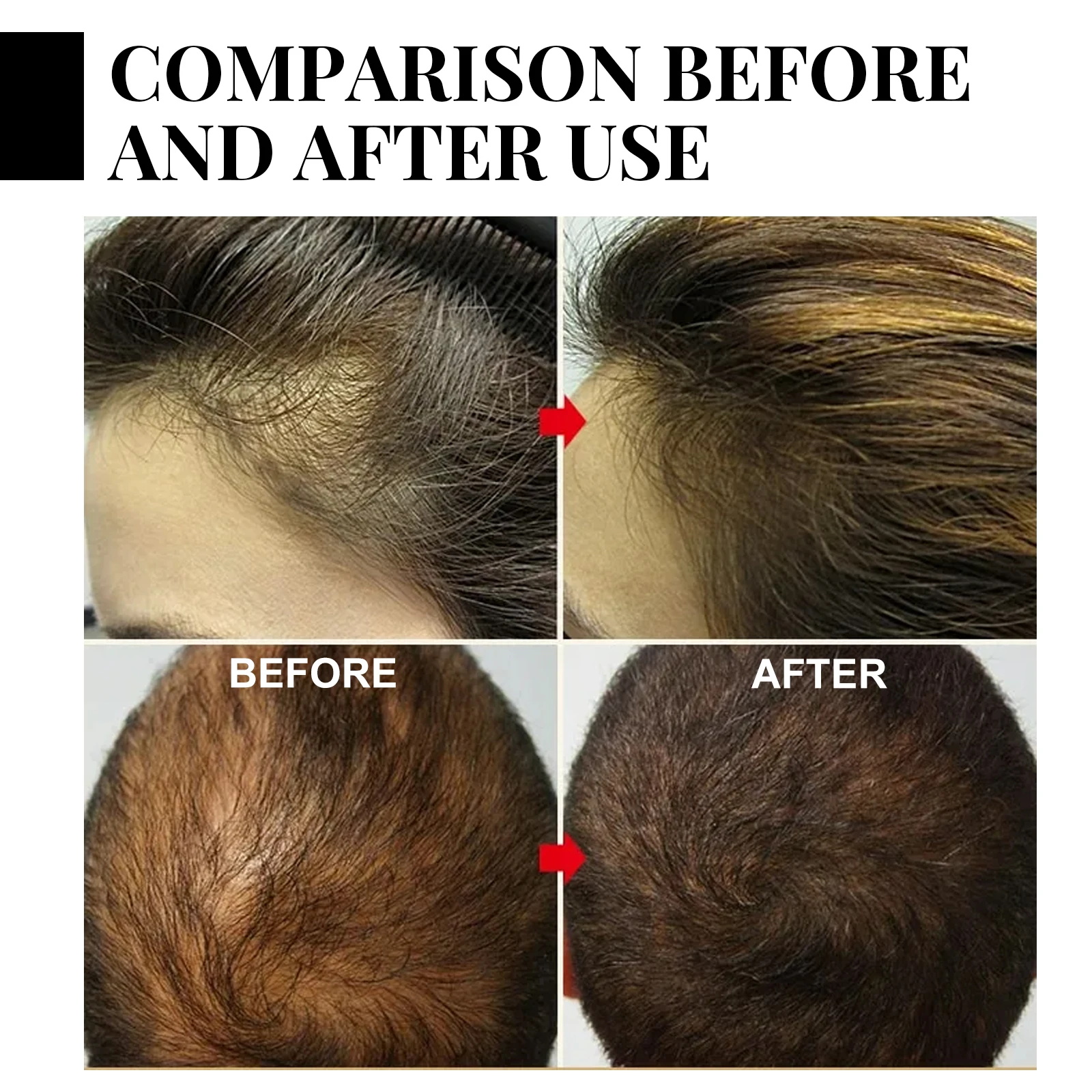 Ginger Hair Growth spray Anti  - Hair Care Nutrition recensione e prezzo