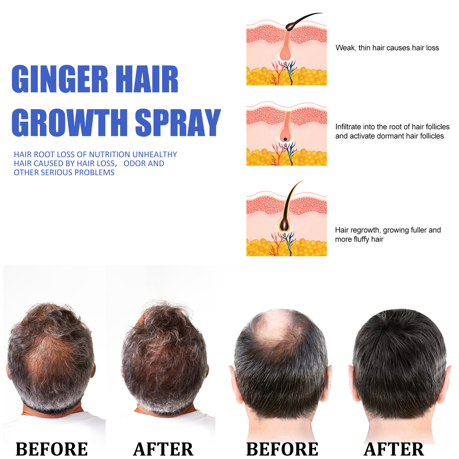 Ginger Hair Growth spray Anti  - Hair Care Nutrition recensione e prezzo