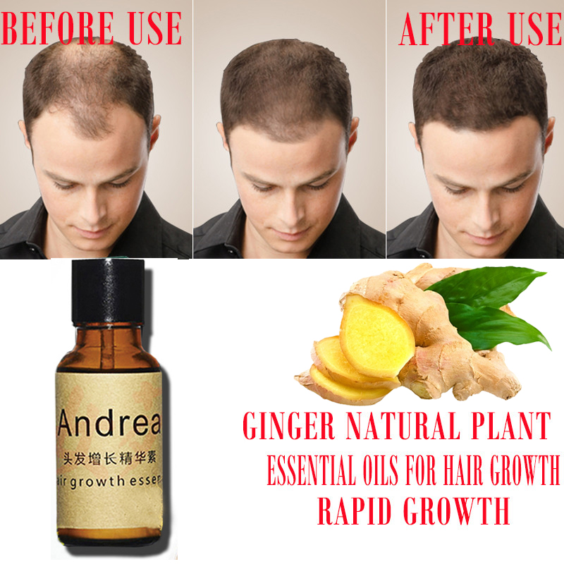 2/5/10Pcs Andrea Hair Growth S - Hair Care Herbal Products recensione e prezzo