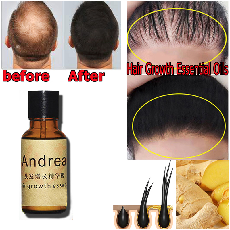 2/5/10Pcs Andrea Hair Growth S - Hair Care Herbal Products recensione e prezzo